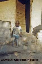Mpika, Zambia - Chilonga Hospital 6 yr old boy